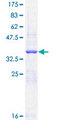 NPRB / NPR2 Protein - 12.5% SDS-PAGE Stained with Coomassie Blue.