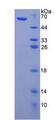NR1H4 / FXR Protein - Recombinant  Farnesoid X Receptor By SDS-PAGE