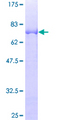 NSBP1 / HMGN5 Protein - 12.5% SDS-PAGE of human NSBP1 stained with Coomassie Blue