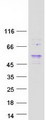 NSMCE4A / NSE4A Protein - Purified recombinant protein NSMCE4A was analyzed by SDS-PAGE gel and Coomassie Blue Staining