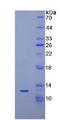 NT-proBNP Protein - Recombinant N-Terminal Pro-Brain Natriuretic Peptide By SDS-PAGE