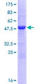 NTMT1 / C9orf32 Protein - 12.5% SDS-PAGE of human C9orf32 stained with Coomassie Blue