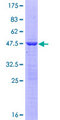 NTPCR / C1orf57 Protein - 12.5% SDS-PAGE of human C1orf57 stained with Coomassie Blue