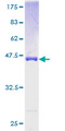 NUDT10 Protein - 12.5% SDS-PAGE of human NUDT10 stained with Coomassie Blue