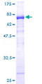 NUDT12 Protein - 12.5% SDS-PAGE of human NUDT12 stained with Coomassie Blue