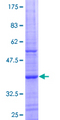 NUDT13 Protein - 12.5% SDS-PAGE Stained with Coomassie Blue.