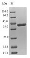 NUDT2 Protein - (Tris-Glycine gel) Discontinuous SDS-PAGE (reduced) with 5% enrichment gel and 15% separation gel.