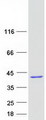 NUDT22 Protein - Purified recombinant protein NUDT22 was analyzed by SDS-PAGE gel and Coomassie Blue Staining
