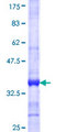 NUP133 Protein - 12.5% SDS-PAGE Stained with Coomassie Blue.