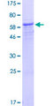 NUP37 Protein - 12.5% SDS-PAGE of human NUP37 stained with Coomassie Blue