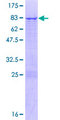NUP54 Protein - 12.5% SDS-PAGE of human NUP54 stained with Coomassie Blue