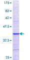 NXF2 Protein - 12.5% SDS-PAGE Stained with Coomassie Blue.
