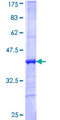 NXF5 Protein - 12.5% SDS-PAGE Stained with Coomassie Blue.