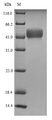 NXP2 / MORC3 Protein - (Tris-Glycine gel) Discontinuous SDS-PAGE (reduced) with 5% enrichment gel and 15% separation gel.