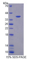 OAT Protein - Recombinant Ornithine Aminotransferase By SDS-PAGE