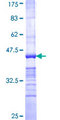 Obscurin / OBSCN Protein - 12.5% SDS-PAGE Stained with Coomassie Blue.