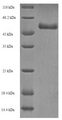 ODAM Protein - (Tris-Glycine gel) Discontinuous SDS-PAGE (reduced) with 5% enrichment gel and 15% separation gel.