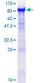 OGFOD1 Protein - 12.5% SDS-PAGE of human OGFOD1 stained with Coomassie Blue