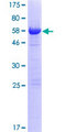 OGFOD2 Protein - 12.5% SDS-PAGE of human OGFOD2 stained with Coomassie Blue