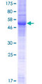 OPPO1 / ODF4 Protein - 12.5% SDS-PAGE of human ODF4 stained with Coomassie Blue