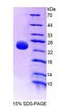 OPTIMEDIN / OLFM3 Protein - Recombinant Olfactomedin 3 By SDS-PAGE