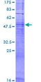 OR11L1 Protein - 12.5% SDS-PAGE of human OR11L1 stained with Coomassie Blue