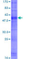 OR1J2 Protein - 12.5% SDS-PAGE of human OR1J2 stained with Coomassie Blue