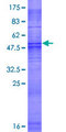 OR1S2 Protein - 12.5% SDS-PAGE of human OR1S2 stained with Coomassie Blue