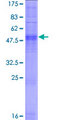 OR2M3 Protein - 12.5% SDS-PAGE of human OR2M3 stained with Coomassie Blue