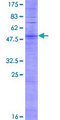 OR2Y1 Protein - 12.5% SDS-PAGE of human OR2Y1 stained with Coomassie Blue