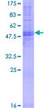 OR4B1 Protein - 12.5% SDS-PAGE of human OR4B1 stained with Coomassie Blue