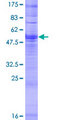 OR4D10 Protein - 12.5% SDS-PAGE of human OR4D10 stained with Coomassie Blue