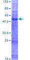 OR4M2 Protein - 12.5% SDS-PAGE of human OR4M2 stained with Coomassie Blue