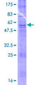 OR52A1 Protein - 12.5% SDS-PAGE of human OR52A1 stained with Coomassie Blue