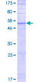 OR52E6 Protein - 12.5% SDS-PAGE of human OR52E6 stained with Coomassie Blue