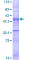 OR5A1 Protein - 12.5% SDS-PAGE of human OR5A1 stained with Coomassie Blue