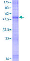 OR5F1 Protein - 12.5% SDS-PAGE of human OR5F1 stained with Coomassie Blue