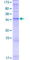 OR5J2 Protein - 12.5% SDS-PAGE of human OR5J2 stained with Coomassie Blue