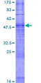 OR6K2 Protein - 12.5% SDS-PAGE of human OR6K2 stained with Coomassie Blue