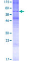 OR6K6 Protein - 12.5% SDS-PAGE of human OR6K6 stained with Coomassie Blue