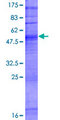 OR6N2 Protein - 12.5% SDS-PAGE of human OR6N2 stained with Coomassie Blue
