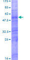 OR9G4 Protein - 12.5% SDS-PAGE of human OR9G4 stained with Coomassie Blue
