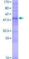 OR9K2 Protein - 12.5% SDS-PAGE of human OR9K2 stained with Coomassie Blue