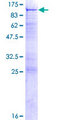 OSBPL10 Protein - 12.5% SDS-PAGE of human OSBPL10 stained with Coomassie Blue
