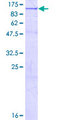 OSBPL11 Protein - 12.5% SDS-PAGE of human OSBPL11 stained with Coomassie Blue