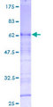 OSER1 / C20orf111 Protein - 12.5% SDS-PAGE of human C20orf111 stained with Coomassie Blue