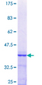 OSGIN1 Protein - 12.5% SDS-PAGE Stained with Coomassie Blue.