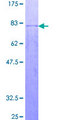 OSGIN2 Protein - 12.5% SDS-PAGE of human C8orf1 stained with Coomassie Blue