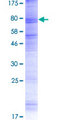OTOP2 Protein - 12.5% SDS-PAGE of human OTOP2 stained with Coomassie Blue