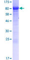 OTUD5 Protein - 12.5% SDS-PAGE of human OTUD5 stained with Coomassie Blue